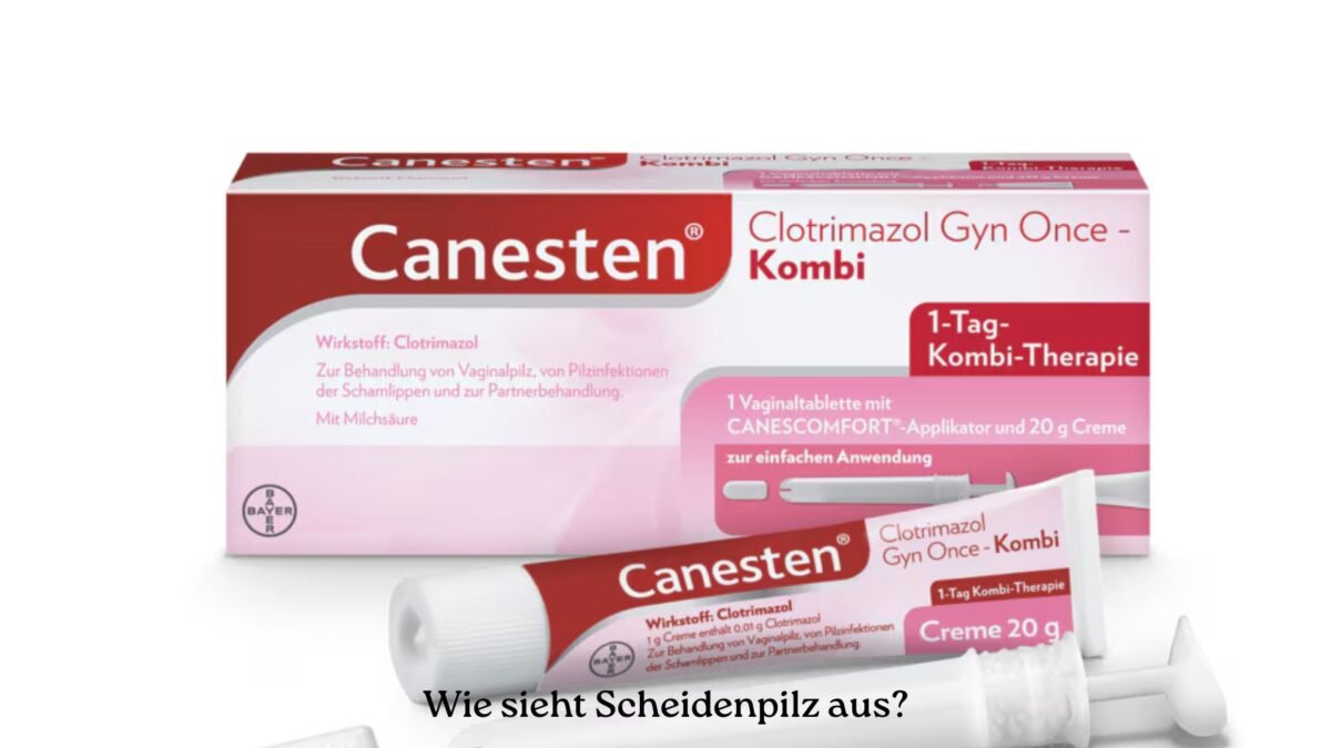 Wie sieht Scheidenpilz aus?