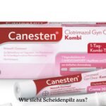 Wie sieht Scheidenpilz aus?